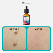 Warticide - Warts and Mole Remover 15ml